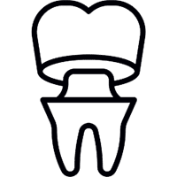 Dental Crowns in Allen, TX - SAKS Dental Studio