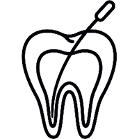 Root Canals in Allen, TX - SAKS Dental Studio