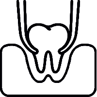 Tooth Extraction in Allen, TX - SAKS Dental Studio