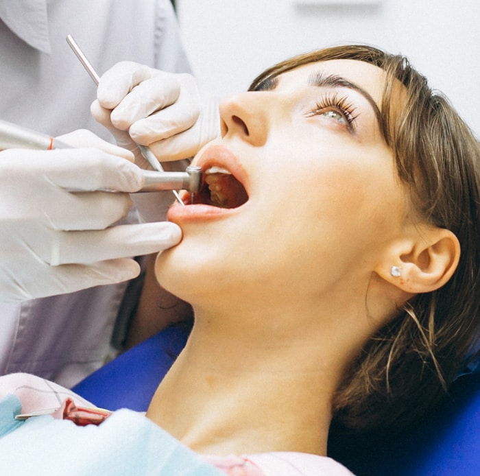 What Happens During The Root Canal Procedure - Root Canals in Allen, TX - SAKS Dental Studio