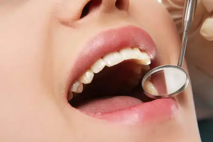 dental exam and teeth cleaning in Allen