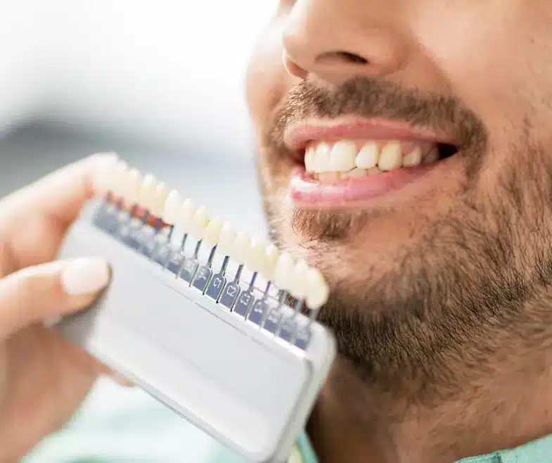 male patient smiling during porcelain veneer shade selection in Allen